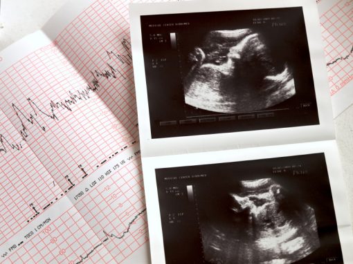 Two new U.S. states pass legislation banning abortion when a foetal heartbeat is detected