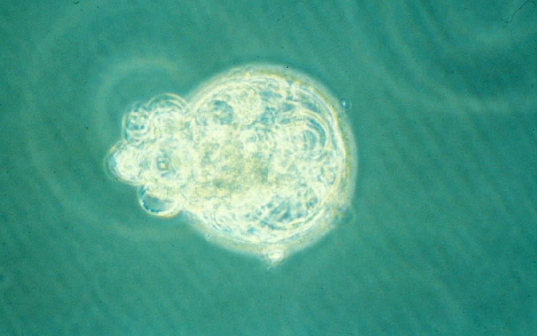 La Cour administrative d’appel de Versailles annule deux autorisations de recherche sur l’embryon humain et sur les cellules souches embryonnaires humaines