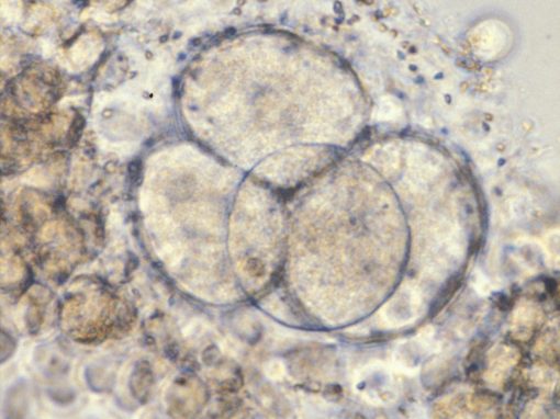 Des cellules souches embryonnaires humaines utilisées pour modéliser le développement de l’embryon au-delà de 14 jours