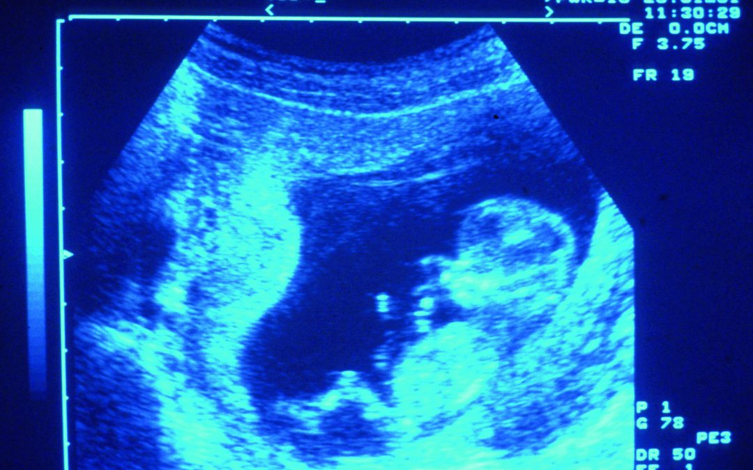 Abortion: Texas reacts to Supreme Court decisions. Indiana once again under attack from the Family Planning Association