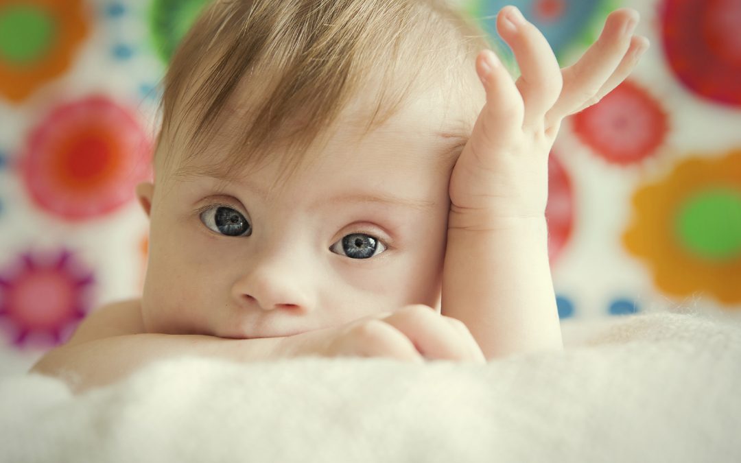 Finland, 70% of foetuses diagnosed with Down syndrome are aborted