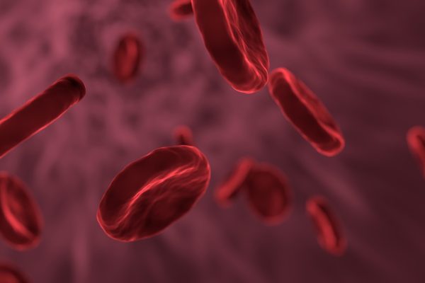 Thérapie génique de la drépanocytose : une augmentation du risque de cancer du sang