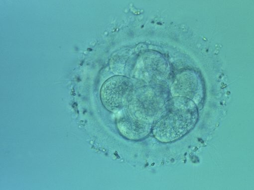 Embryon humain