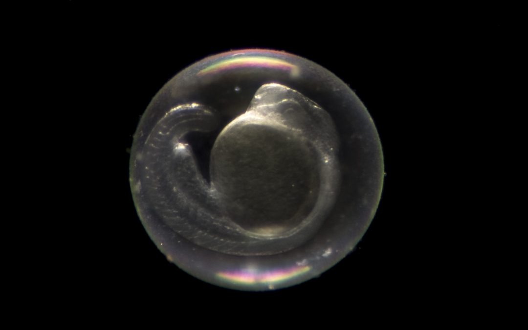 Des embryons scrutés par IRM
