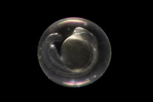 Un « contrôle qualité » lors du développement de l’embryon ?