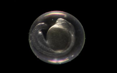 L’avortement : un « instrument » de la recherche sur l’embryon ?