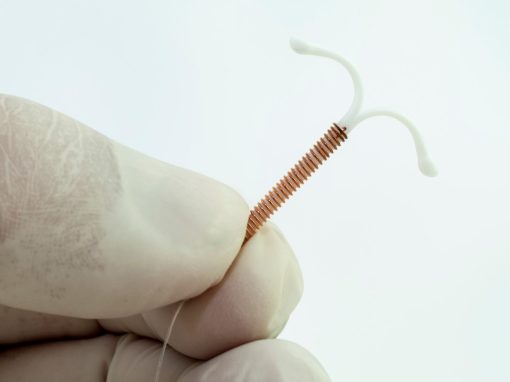 Contraception : le DIU aurait des effets bien au-delà de l’utérus