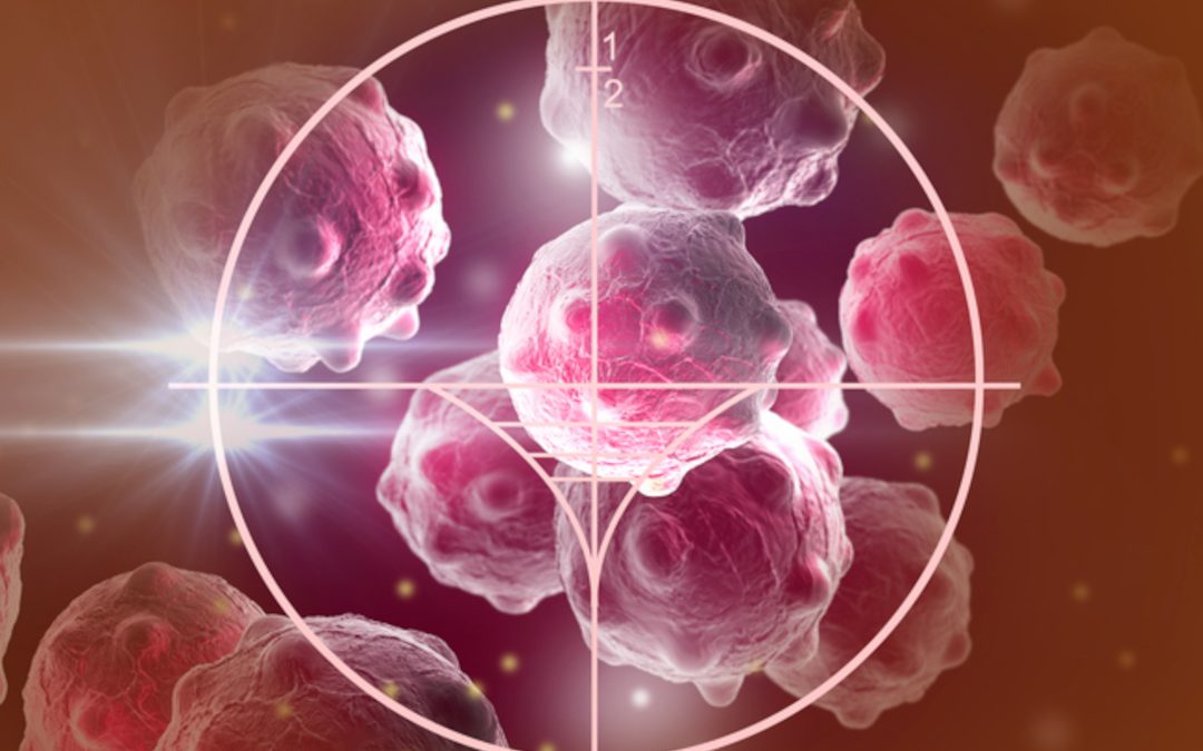 Greffe de cellules souches : un patient en rémission du VIH et de la leucémie