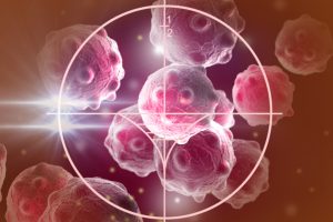 Greffe de cellules souches : un patient en rémission du VIH et de la leucémie